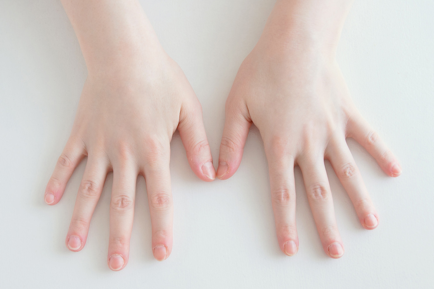 Female manicure. Before and after